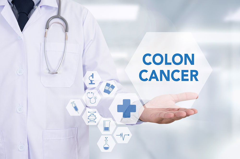 Causes, Symptoms, and Diagnosis of Colon Cancer