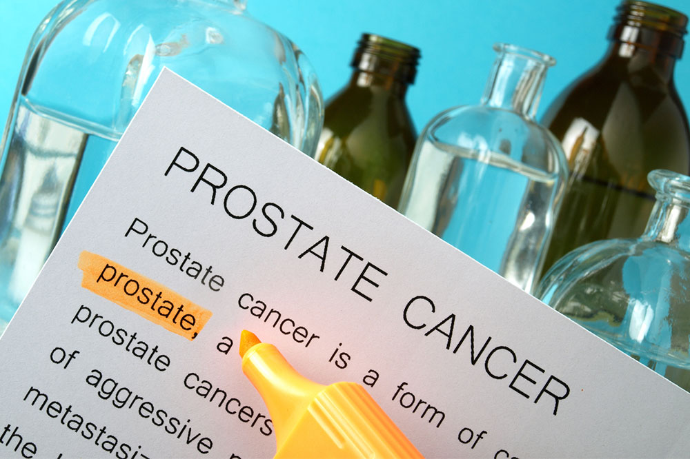 Symptoms and Stages of Prostate Cancer