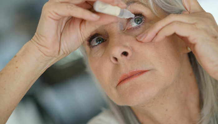 Types and Treatment Options for Dry Eyes